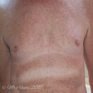 man's tan chest with white stripes